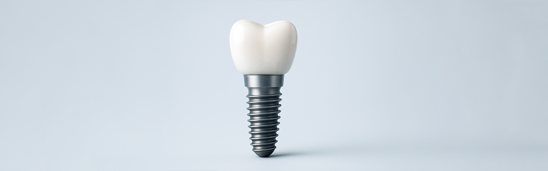 Why Dental Implants Are a Smart Investment