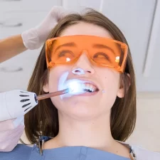 Why Dental Bonding Is a Popular Smile Fix for Houston Residents